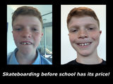 Filename=Robert_s_teeth.jpg
Filesize=1445KiB
Dimensions=2048x1536
Date added=Nov 07, 2015 Robert_s_teeth.jpg
